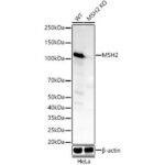 [KO Validated] MSH2 Rabbit mAb (A22177)