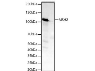 [KO Validated] MSH2 Rabbit mAb (A22177)