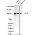 A22177: [KO Validated] MSH2 Rabbit mAb