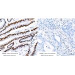 [KO Validated] MSH2 Rabbit mAb (Catalog Number: A22177) Abclonal