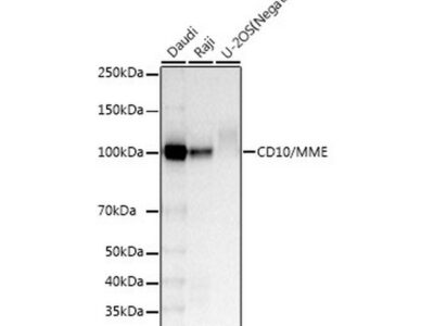 CD10/MME Rabbit mAb (A22179)