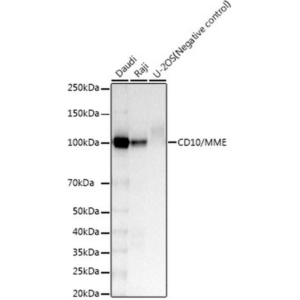 CD10/MME Rabbit mAb (A22179)