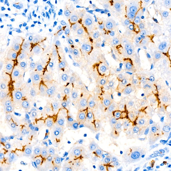 A22179: CD10/MME Rabbit mAb