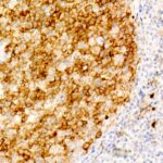CD10/MME Rabbit mAb (Catalog Number: A22179) Abclonal