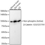Non-phospho (Active)β-Catenin -S33/S37/T41 Rabbit mAb (A22180)