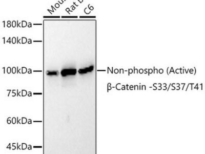 Non-phospho (Active)β-Catenin -S33/S37/T41 Rabbit mAb (A22180)