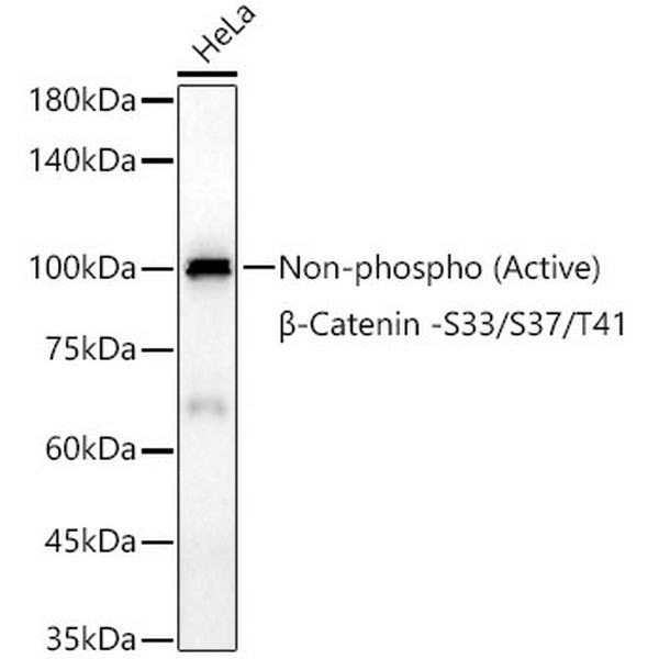 A22180: Non-phospho (Active)β-Catenin -S33/S37/T41 Rabbit mAb