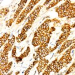 Non-phospho (Active)β-Catenin -S33/S37/T41 Rabbit mAb (Catalog Number: A22180) Abclonal