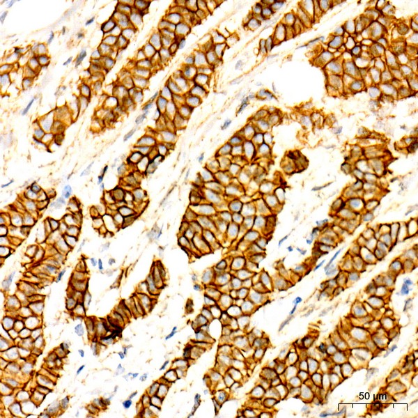 Non-phospho (Active)β-Catenin -S33/S37/T41 Rabbit mAb (Catalog Number: A22180) Abclonal