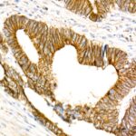 Abclonal Non-phospho (Active)β-Catenin -S33/S37/T41 Rabbit mAb (Catalog Number: A22180)