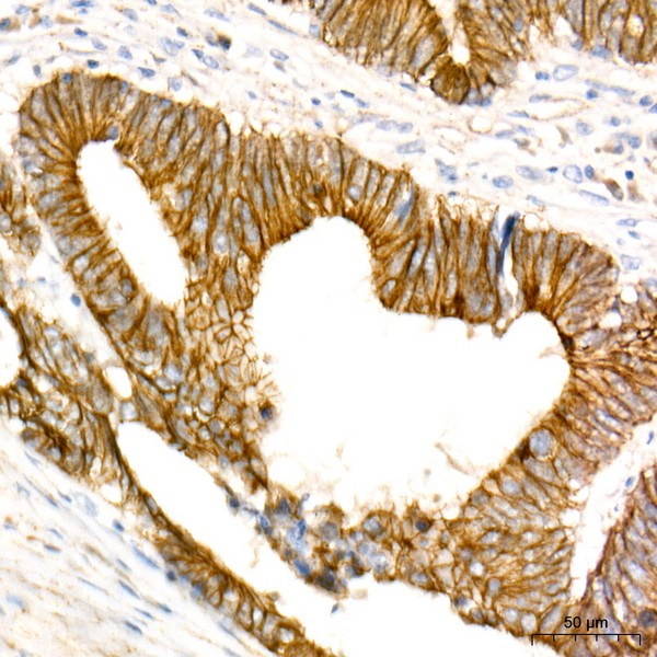Abclonal Non-phospho (Active)β-Catenin -S33/S37/T41 Rabbit mAb (Catalog Number: A22180)