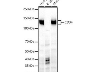 CD34 Rabbit mAb (A22197)