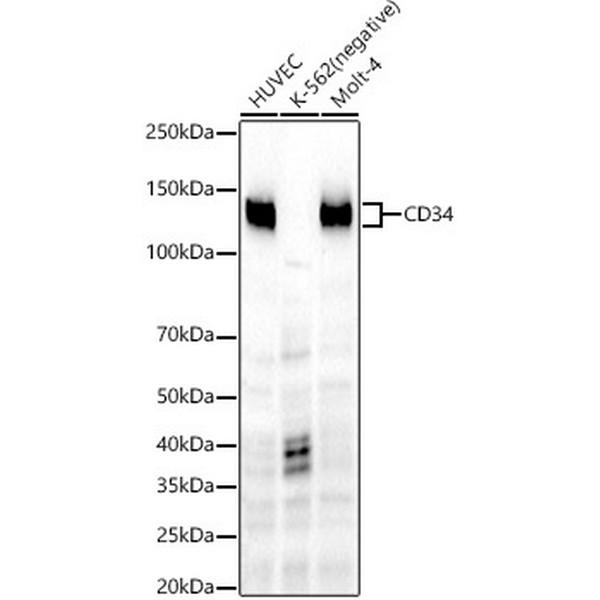 CD34 Rabbit mAb (A22197)