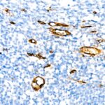 Abclonal CD34 Rabbit mAb (Catalog Number: A22197)