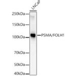 PSMA/FOLH1 Rabbit mAb (A22211)