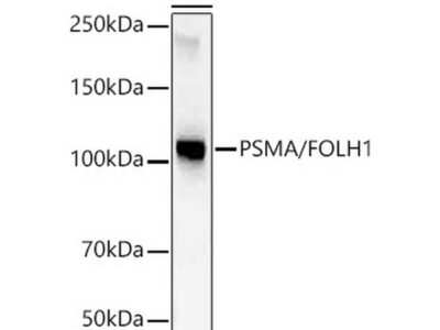 PSMA/FOLH1 Rabbit mAb (A22211)