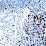 CD8A Rabbit mAb (A22219)