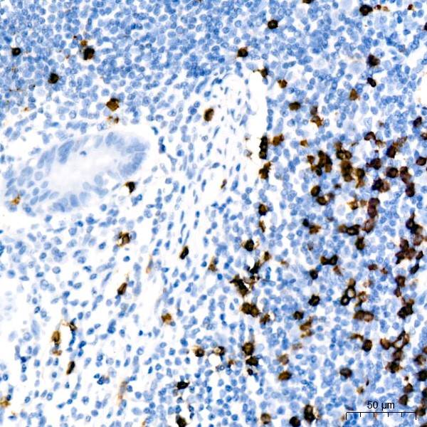 CD8A Rabbit mAb (A22219) CD8A Rabbit mAb (A22219)