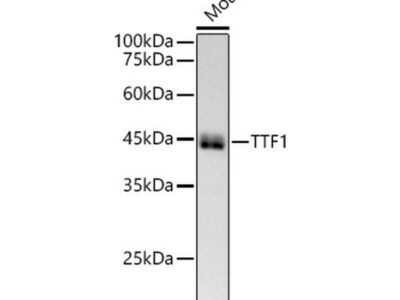 NKX2-1 Rabbit mAb (A22247)