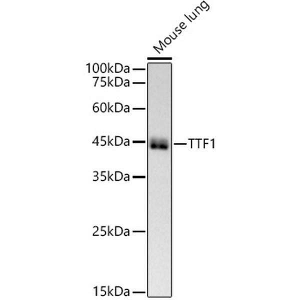 NKX2-1 Rabbit mAb (A22247) NKX2-1 Rabbit mAb (A22247)