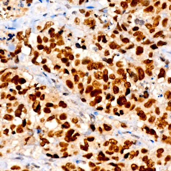 TTF1 Rabbit mAb (A22248) TTF1 Rabbit mAb (A22248)