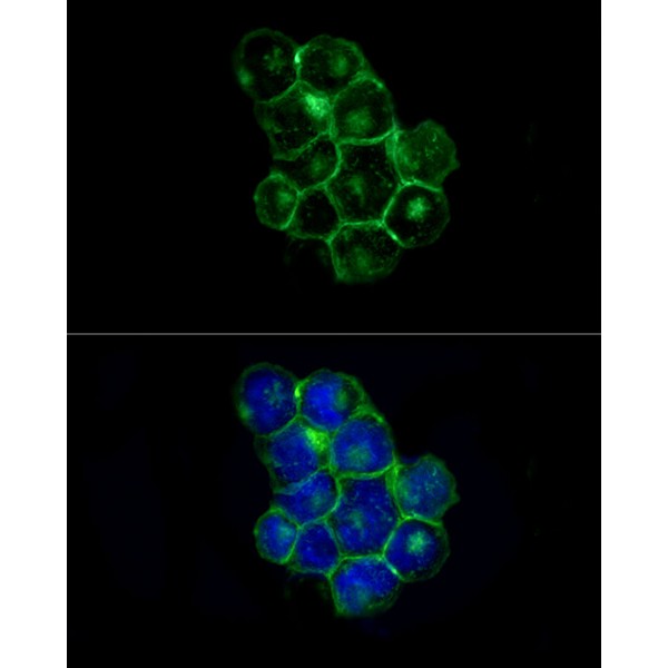 ABflo® 488 Rabbit anti-Human CD225/IFITM1 mAb (A22310) ABflo® 488 Rabbit anti-Human CD225/IFITM1 mAb (A22310)
