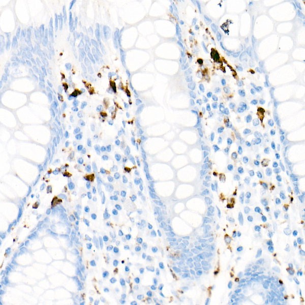 CD68 Rabbit mAb (Catalog Number: A22329) Abclonal