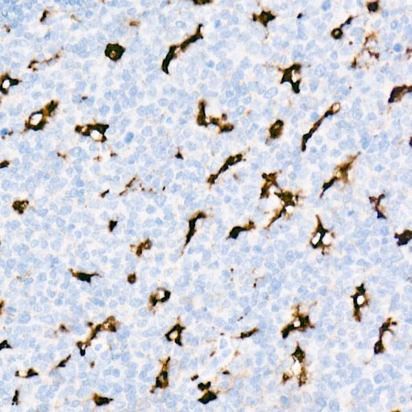 Abclonal CD68 Rabbit mAb (Catalog Number: A22329)