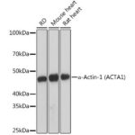 α-Actin-1 (α-SMA) Rabbit mAb (A2235)