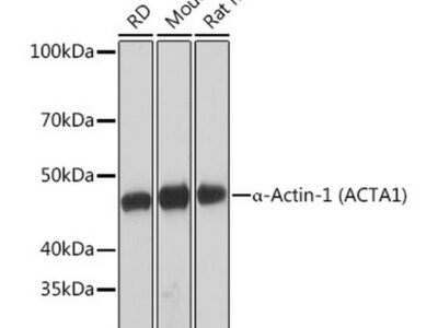 α-Actin-1 (α-SMA) Rabbit mAb (A2235)