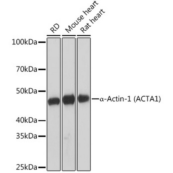 α-Actin-1 (α-SMA) Rabbit mAb (A2235) α-Actin-1 (α-SMA) Rabbit mAb (A2235)