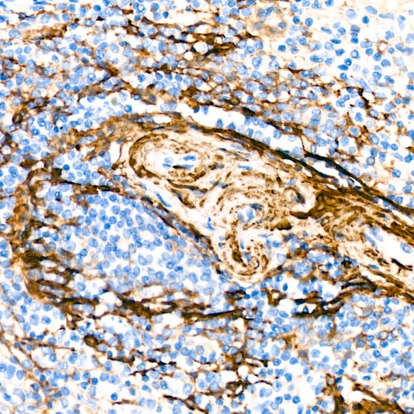 Abclonal α-Actin-1 (α-SMA) Rabbit mAb (Catalog Number: A2235)