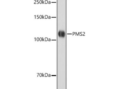 [KO Validated] PMS2 Rabbit mAb (A22350)