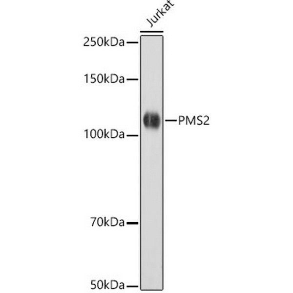 [KO Validated] PMS2 Rabbit mAb (A22350)