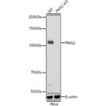 A22350: [KO Validated] PMS2 Rabbit mAb