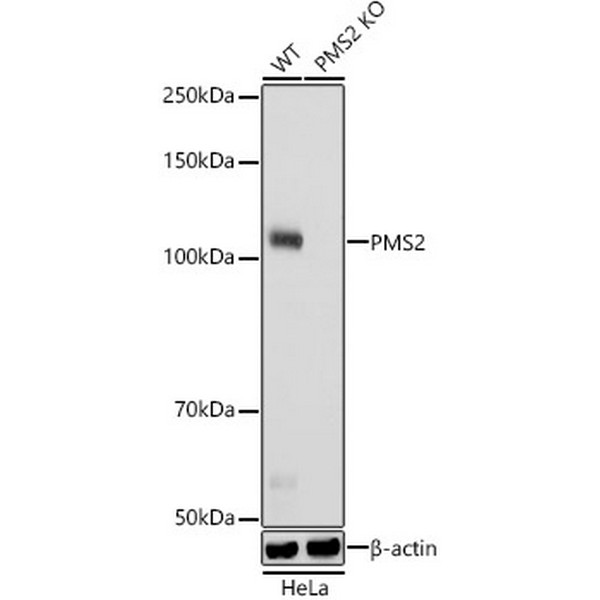 A22350: [KO Validated] PMS2 Rabbit mAb
