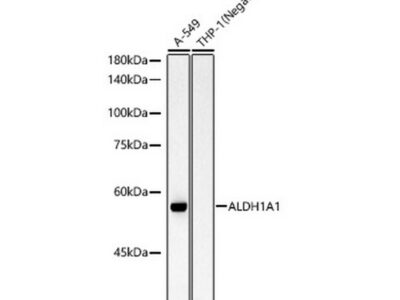 ALDH1A1 Rabbit mAb (A22351)