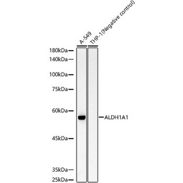 ALDH1A1 Rabbit mAb (A22351) ALDH1A1 Rabbit mAb (A22351)