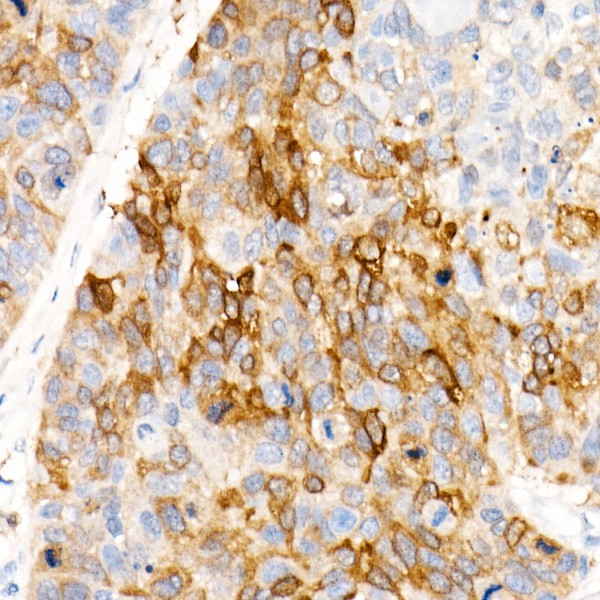 A22351: ALDH1A1 Rabbit mAb