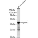 Cyclin E1 Rabbit mAb (A22360)