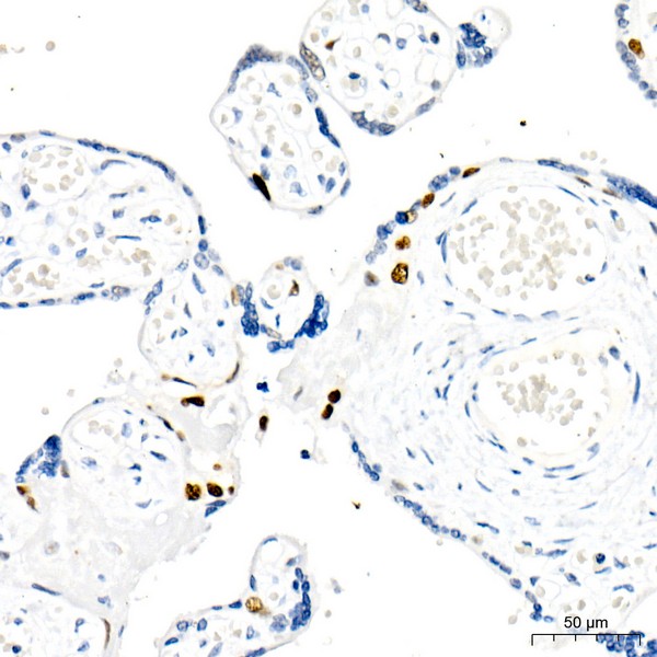 Abclonal Cyclin E1 Rabbit mAb (Catalog Number: A22360)