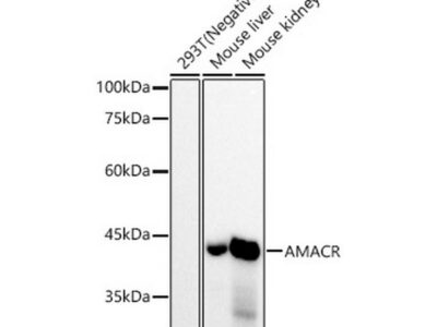 AMACR/p504S Rabbit mAb (A22407)