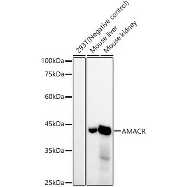 AMACR/p504S Rabbit mAb (A22407)