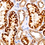AMACR/p504S Rabbit mAb (Catalog Number: A22407) Abclonal