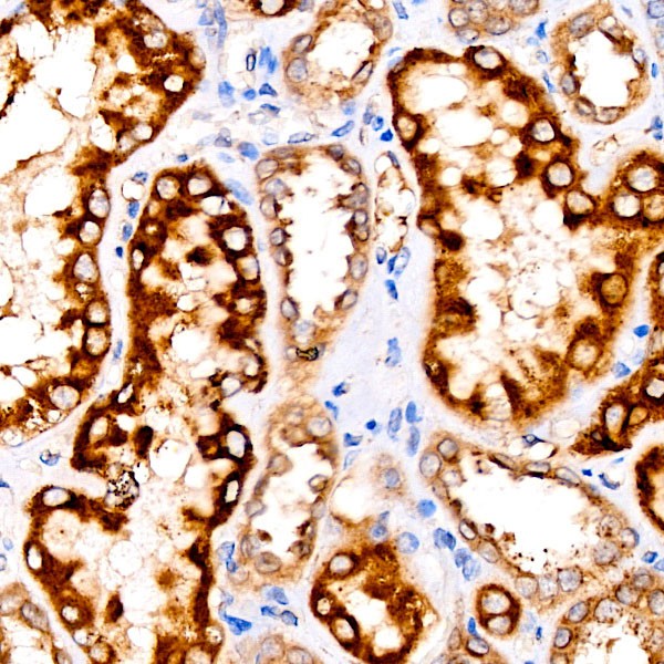 AMACR/p504S Rabbit mAb (Catalog Number: A22407) Abclonal