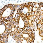 Cytokeratin 19 (KRT19) Rabbit mAb (A22427)