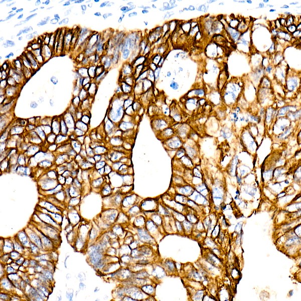 Cytokeratin 19 (KRT19) Rabbit mAb (A22427) Cytokeratin 19 (KRT19) Rabbit mAb (A22427)