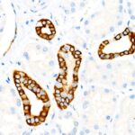 A22427: Cytokeratin 19 (KRT19) Rabbit mAb