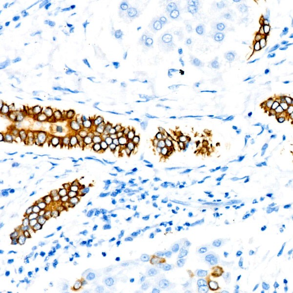 Cytokeratin 19 (KRT19) Rabbit mAb (Catalog Number: A22427) Abclonal