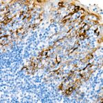 Abclonal Cytokeratin 19 (KRT19) Rabbit mAb (Catalog Number: A22427)